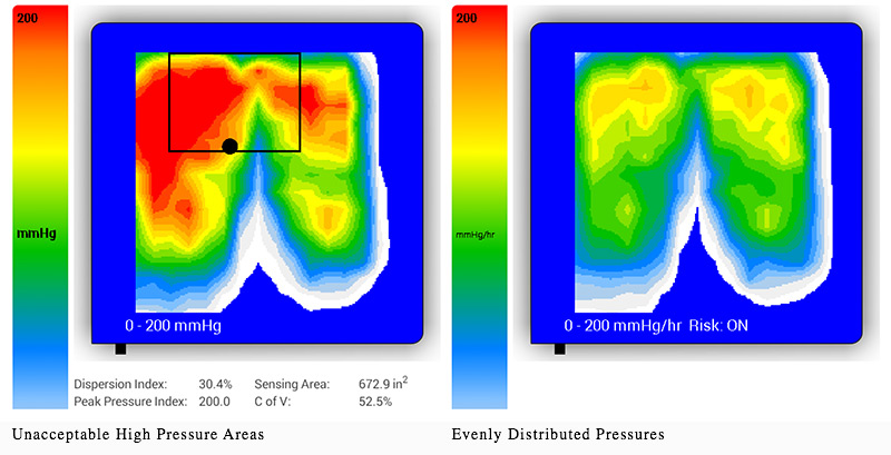 BodiTrak Pressure Map